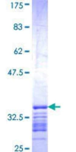 Novus Biologicals Recombinant Human DOK5 GST (N-Term) Protein 25 &mu;g | Buy Online | Novus Biologicals&trade; | Fisher Scientific