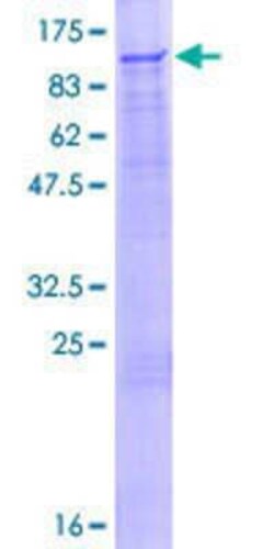 Novus Biologicals Recombinant Human NRIP GST (N-Term) Protein 25 &mu;g | Buy Online | Novus Biologicals&trade; | Fisher Scientific