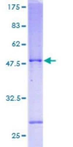 Novus Biologicals Recombinant Human SELS GST (N-Term) Protein 25 &mu;g | Buy Online | Novus Biologicals&trade; | Fisher Scientific