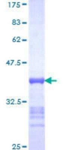 Novus Biologicals Recombinant Human TIP120A GST (N-Term) Protein 25 &mu;g | Buy Online | Novus Biologicals&trade; | Fisher Scientific