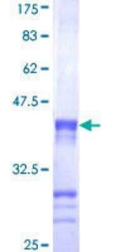 Novus Biologicals Recombinant Human CENPJ GST (N-Term) Protein 10 &mu;g | Buy Online | Novus Biologicals&trade; | Fisher Scientific