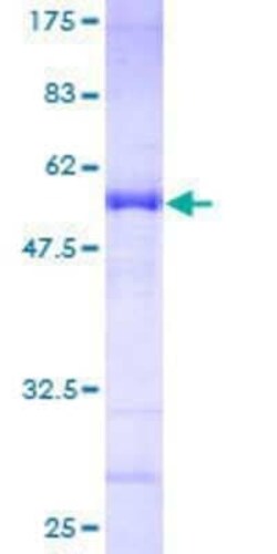 Novus Biologicals Recombinant Human CENPN GST (N-Term) Protein 25 &mu;g | Buy Online | Novus Biologicals&trade; | Fisher Scientific