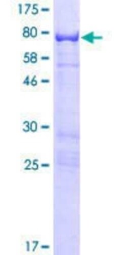 Novus Biologicals Recombinant Human ARHGAP15 GST (N-Term) Protein 10 &mu;g | Buy Online | Novus Biologicals&trade; | Fisher Scientific
