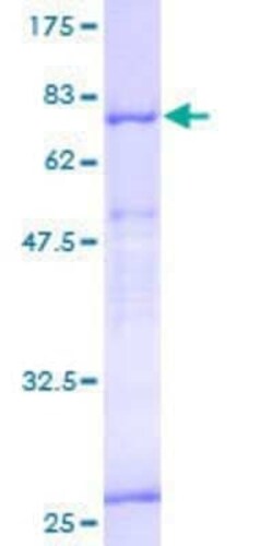 Novus Biologicals Recombinant Human MDS028 GST (N-Term) Protein 10 &mu;g | Buy Online | Novus Biologicals&trade; | Fisher Scientific