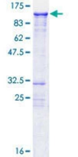 Novus Biologicals Recombinant Human KIZUNA GST (N-Term) Protein 10 &mu;g | Buy Online | Novus Biologicals&trade; | Fisher Scientific