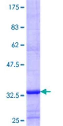 Novus Biologicals Recombinant Human SLC22A11 GST (N-Term) Protein 25 &mu;g | Buy Online | Novus Biologicals&trade; | Fisher Scientific