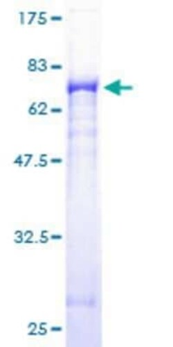 Novus Biologicals Recombinant Human Gasdermin like GST (N-Term) Protein 25 &mu;g | Buy Online | Novus Biologicals&trade; | Fisher Scientific