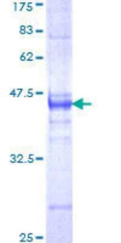 Novus Biologicals Recombinant Human ZNF167 GST (N-Term) Protein 25 &mu;g | Buy Online | Novus Biologicals&trade; | Fisher Scientific