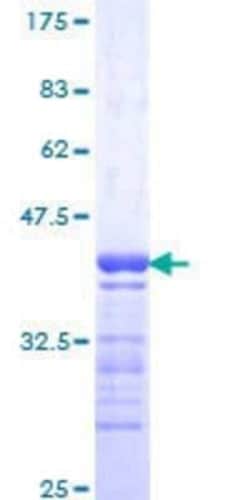 Novus Biologicals Recombinant Human GPRC5C GST (N-Term) Protein 25 &mu;g | Buy Online | Novus Biologicals&trade; | Fisher Scientific
