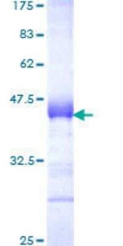 Novus Biologicals Recombinant Human Myoneurin GST (N-Term) Protein 10 &mu;g | Buy Online | Novus Biologicals&trade; | Fisher Scientific