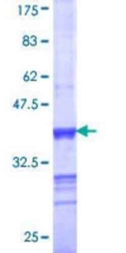 Novus Biologicals Recombinant Human BIN3 GST (N-Term) Protein 10 &mu;g | Buy Online | Novus Biologicals&trade; | Fisher Scientific