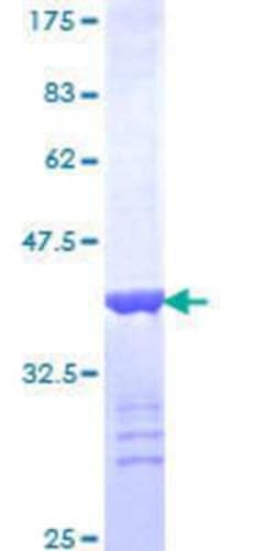 Novus Biologicals Recombinant Human Erbin GST (N-Term) Protein 25 &mu;g | Buy Online | Novus Biologicals&trade; | Fisher Scientific