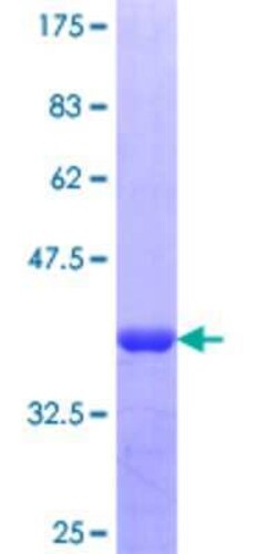 Novus Biologicals Recombinant Human NKRF GST (N-Term) Protein 25 &mu;g | Buy Online | Novus Biologicals&trade; | Fisher Scientific