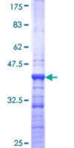 Novus Biologicals Recombinant Human DMAP1 GST (N-Term) Protein 10 &mu;g | Buy Online | Novus Biologicals&trade; | Fisher Scientific
