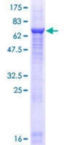 Novus Biologicals Recombinant Human MYO5C GST (N-Term) Protein 10 &mu;g | Buy Online | Novus Biologicals&trade; | Fisher Scientific