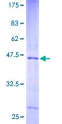 Novus Biologicals Recombinant Human NDUFA12 GST (N-Term) Protein 10 &mu;g | Buy Online | Novus Biologicals&trade; | Fisher Scientific