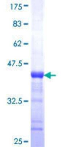 Novus Biologicals Recombinant Human BAIAP2L1 GST (N-Term) Protein 25 &mu;g | Buy Online | Novus Biologicals&trade; | Fisher Scientific