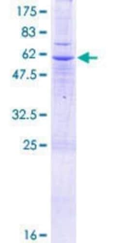 Novus Biologicals Recombinant Human SLC25A40 GST (N-Term) Protein 25 &mu;g | Buy Online | Novus Biologicals&trade; | Fisher Scientific