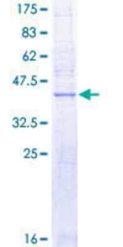 Novus Biologicals Recombinant Human RAG1AP1 GST (N-Term) Protein 10 &mu;g | Buy Online | Novus Biologicals&trade; | Fisher Scientific