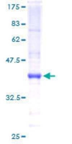 Novus Biologicals Recombinant Human BarX1 GST (N-Term) Protein 10 &mu;g | Buy Online | Novus Biologicals&trade; | Fisher Scientific