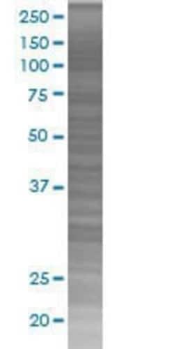 Novus Biologicals PDGF-C 293T Cell Transient Overexpression Lysate 0.1 mL | Buy Online | Novus Biologicals&trade; | Fisher Scientific