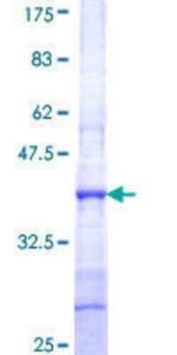 Novus Biologicals Recombinant Human KLHL4 GST (N-Term) Protein 25 &mu;g | Buy Online | Novus Biologicals&trade; | Fisher Scientific