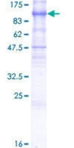 Novus Biologicals Recombinant Human PCDHGB6 GST (N-Term) Protein 10 &mu;g | Buy Online | Novus Biologicals&trade; | Fisher Scientific