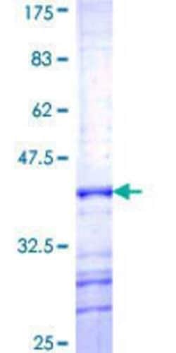 Novus Biologicals Recombinant Human PCDHGB6 GST (N-Term) Protein 10 &mu;g | Buy Online | Novus Biologicals&trade; | Fisher Scientific