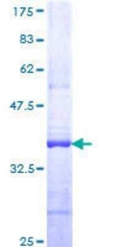 Novus Biologicals Recombinant Human PCDHGB5 GST (N-Term) Protein 10 &mu;g | Buy Online | Novus Biologicals&trade; | Fisher Scientific