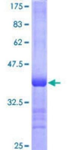 Novus Biologicals Recombinant Human PCDHGA7 GST (N-Term) Protein 10 &mu;g | Buy Online | Novus Biologicals&trade; | Fisher Scientific