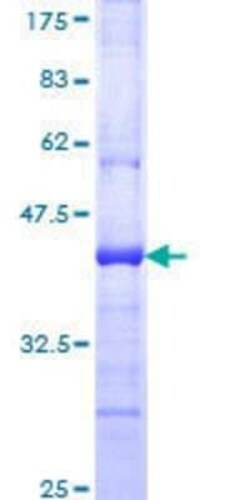Novus Biologicals Recombinant Human PCDHGA6 GST (N-Term) Protein 10 &mu;g | Buy Online | Novus Biologicals&trade; | Fisher Scientific