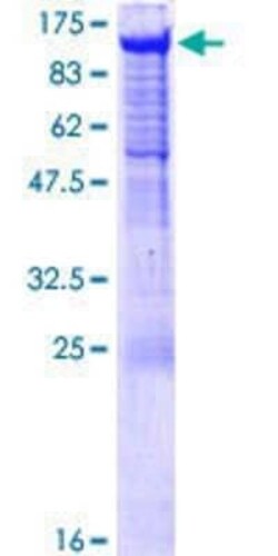 Novus Biologicals Recombinant Human PCDHGA5 GST (N-Term) Protein 10 &mu;g | Buy Online | Novus Biologicals&trade; | Fisher Scientific