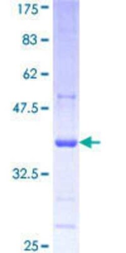 Novus Biologicals Recombinant Human PCDHGA1 GST (N-Term) Protein 25 &mu;g | Buy Online | Novus Biologicals&trade; | Fisher Scientific