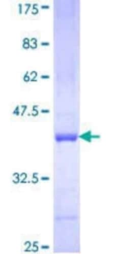 Novus Biologicals Recombinant Human PCDHB15 GST (N-Term) Protein 25 &mu;g | Buy Online | Novus Biologicals&trade; | Fisher Scientific