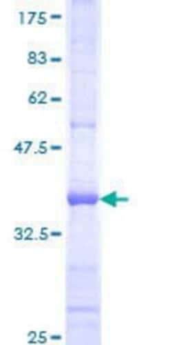 Novus Biologicals Recombinant Human Protocadherin beta 10 GST (N-Term) Protein 25 &mu;g | Buy Online | Novus Biologicals&trade; | Fisher Scientific