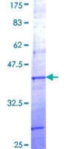 Novus Biologicals Recombinant Human PCDHB7 GST (N-Term) Protein 25 &mu;g | Buy Online | Novus Biologicals&trade; | Fisher Scientific