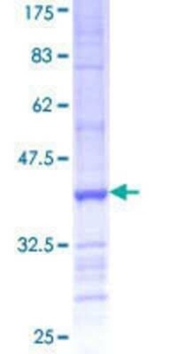 Novus Biologicals Recombinant Human PCDHB6 GST (N-Term) Protein 25 &mu;g | Buy Online | Novus Biologicals&trade; | Fisher Scientific