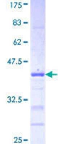 Novus Biologicals Recombinant Human Protocadherin beta 3 GST (N-Term) Protein 25 &mu;g | Buy Online | Novus Biologicals&trade; | Fisher Scientific