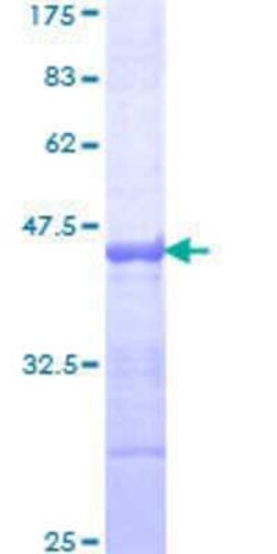 Novus Biologicals Recombinant Human PCDHAC2 GST (N-Term) Protein 10 &mu;g | Buy Online | Novus Biologicals&trade; | Fisher Scientific