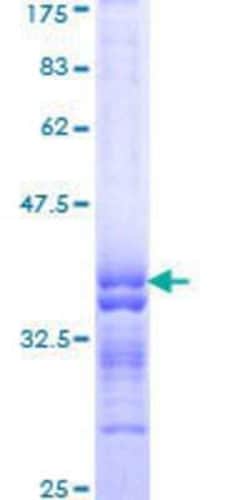 Novus Biologicals Recombinant Human PCDHA11 GST (N-Term) Protein 10 &mu;g | Buy Online | Novus Biologicals&trade; | Fisher Scientific