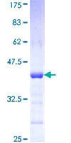 Novus Biologicals Recombinant Human PCDHA7 GST (N-Term) Protein 10 &mu;g | Buy Online | Novus Biologicals&trade; | Fisher Scientific