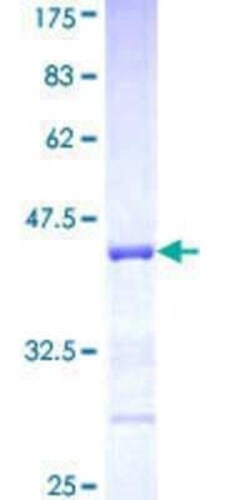 Novus Biologicals Recombinant Human PCDHA5 GST (N-Term) Protein 10 &mu;g | Buy Online | Novus Biologicals&trade; | Fisher Scientific