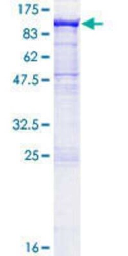 Novus Biologicals Recombinant Human PCDHA2 GST (N-Term) Protein 10 &mu;g | Buy Online | Novus Biologicals&trade; | Fisher Scientific