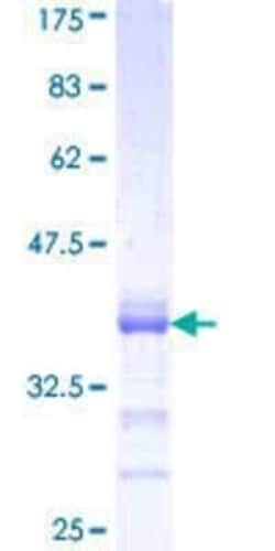 Novus Biologicals Recombinant Human Protocadherin alpha 1 GST (N-Term) Protein 25 &mu;g | Buy Online | Novus Biologicals&trade; | Fisher Scientific
