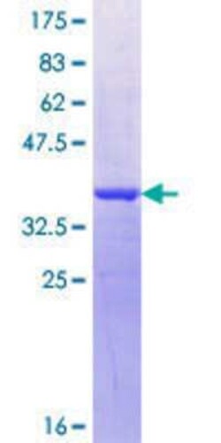 Novus Biologicals Recombinant Human TEX15 GST (N-Term) Protein 10 &mu;g | Buy Online | Novus Biologicals&trade; | Fisher Scientific