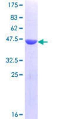 Novus Biologicals Recombinant Human Tex14 GST (N-Term) Protein 25 &mu;g | Buy Online | Novus Biologicals&trade; | Fisher Scientific