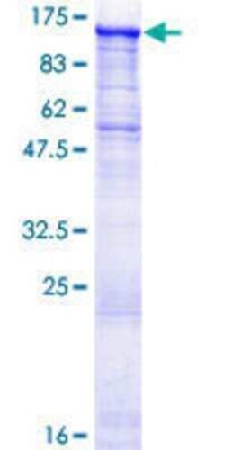 Novus Biologicals Recombinant Human STK31 GST (N-Term) Protein 25 &mu;g | Buy Online | Novus Biologicals&trade; | Fisher Scientific