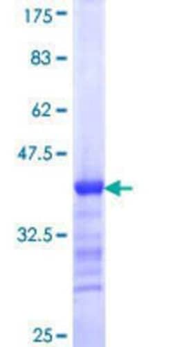 Novus Biologicals Recombinant Human STK31 GST (N-Term) Protein 25 &mu;g | Buy Online | Novus Biologicals&trade; | Fisher Scientific