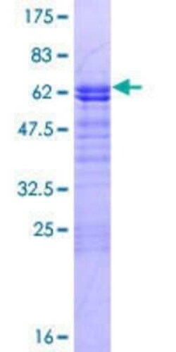 Novus Biologicals Recombinant Human LMOD3 GST (N-Term) Protein 10 &mu;g | Buy Online | Novus Biologicals&trade; | Fisher Scientific