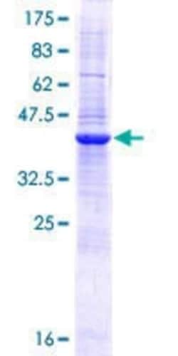 Novus Biologicals Recombinant Human MRAP GST (N-Term) Protein 10 &mu;g | Buy Online | Novus Biologicals&trade; | Fisher Scientific